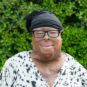 LaQuanda, a Black woman wearing glasses and a black headband scarf, and black and white blouse. LaQuanda has skin scarring that is visible. She smiles in front of greenery, outside.
